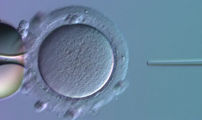 生殖医療のイメージ写真